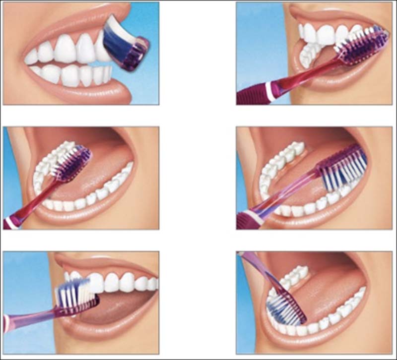 Pravilno pranje zuba - redovno pranje zuba
